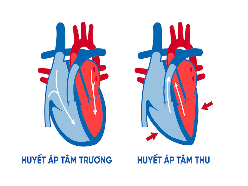 Huyết áp là gì? Phân biệt huyết áp cao và huyết áp thấp - Microlife