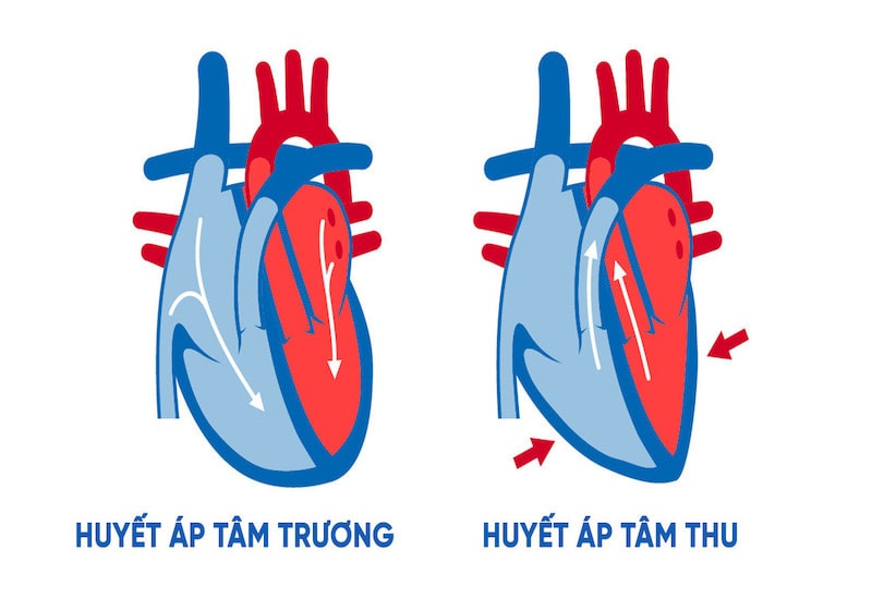 Huyết áp tâm thu là gì? Triệu chứng và phòng ngừa - Microlife